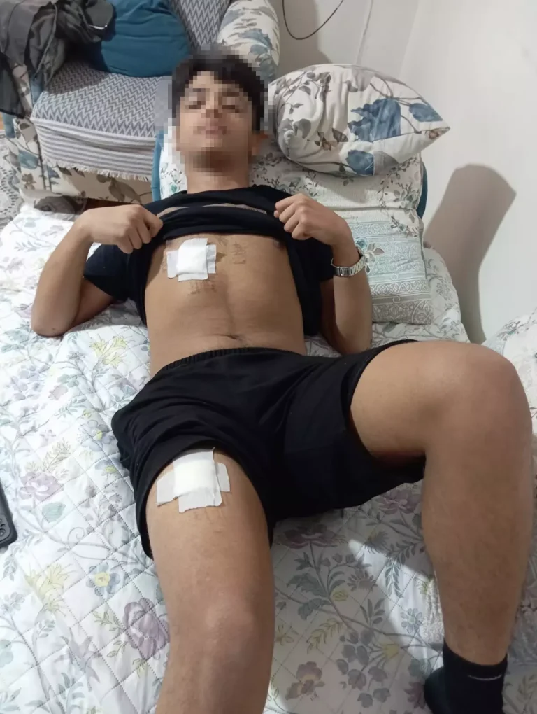 Adana’da Genç Kız Bıçaklandı