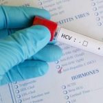 Çin’de 69 hastaya yanlış uygulamalardan hepatit C bulaştı