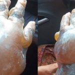 Diş macunu yanıklara iyi gelmiyor