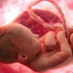 Down sendromuna anne karnında müdahale