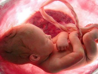 Down sendromuna anne karnında müdahale