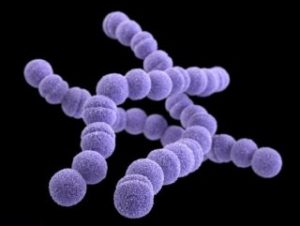 İngiltere’de 12 kişi bakteri yüzünden hayatını kaybetti