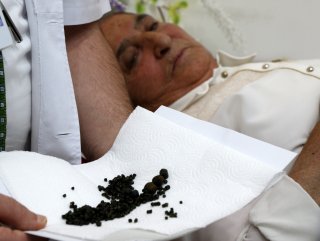 Safra kesesinden 450 tane taş çıktı