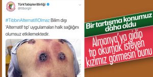 Tabipler Birliği hacamata karşı