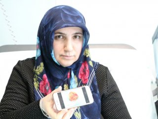 Talihsiz kadının kalbinden kitle çıkarıldı