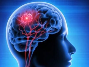 Türk doktordan kanser tedavisinde çığır açacak buluş