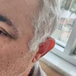 Aile hekimini darbeden müezzin, savcılığın itirazıyla gözaltına alınıp tutuklandı