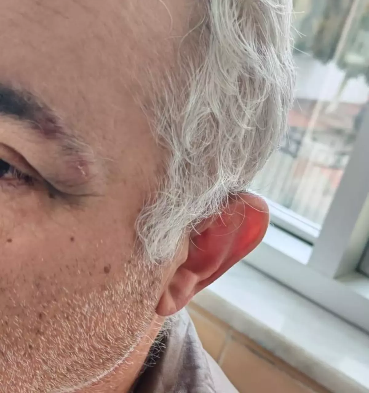 Aile hekimini darbeden müezzin, savcılığın itirazıyla gözaltına alınıp tutuklandı