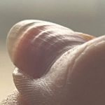 Dalgalı tırnak bakın neyin habercisi! Vücut böyle alarm veriyor…