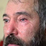 Dolmuş Şoförünün Gözünü Kaybetmesi