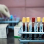 Dünyada her yıl 20 milyon, Türkiye’de ise 240 bin kişi kanser tanısı alıyor