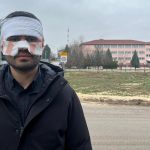 Eskişehir’de rehber öğretmeni, fizik öğretmeninin yüzüne sıcak çay fırlattı