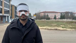 Eskişehir’de rehber öğretmeni, fizik öğretmeninin yüzüne sıcak çay fırlattı