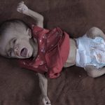 Gazze’de açlık: Filistinli bebeğin yaşam mücadelesi