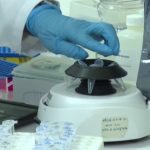 Genç akademisyenden beyin tümörüne dakikalar içinde tanı koyan yerli biyosensör