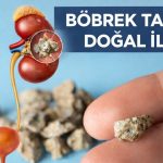 Her gün 1 avuç yiyin: Böbrek taşını kaydırıp atıyor…