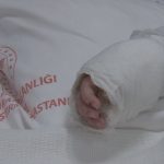 İstanbul’da bebeğin üzerine kaynar su döküldü: Vücudunun yüzde 27’si yandı