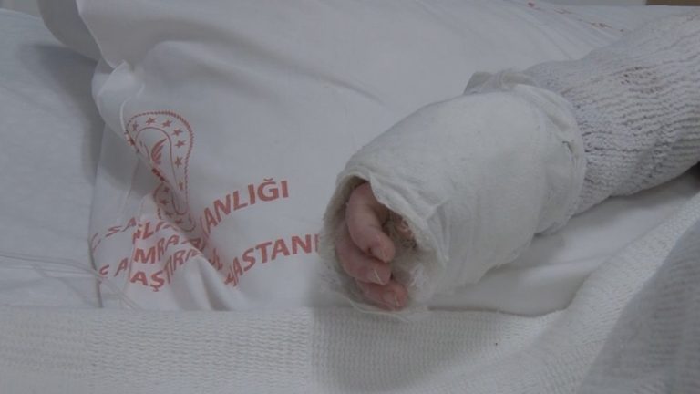 İstanbul’da bebeğin üzerine kaynar su döküldü: Vücudunun yüzde 27’si yandı