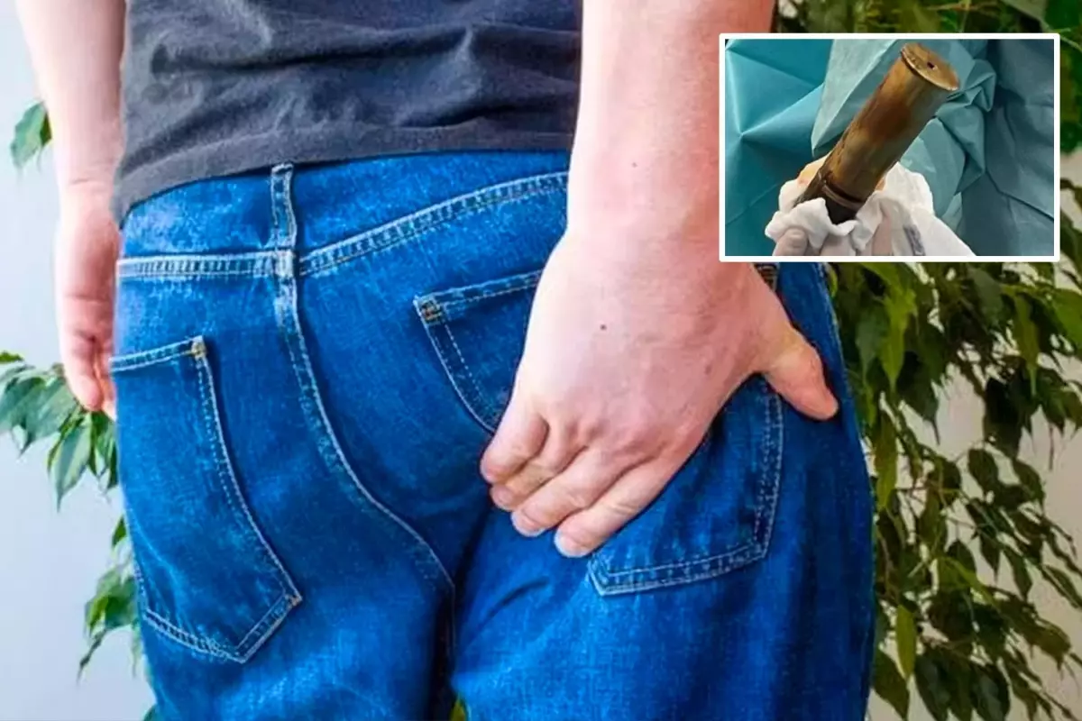 Şiddetli ağrıyla hastaneye başvuran adamın makatından 100 yıllık top mermisi çıktı