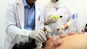 Şubat 2026 hacamat günleri: Sünnet olan tarihler…