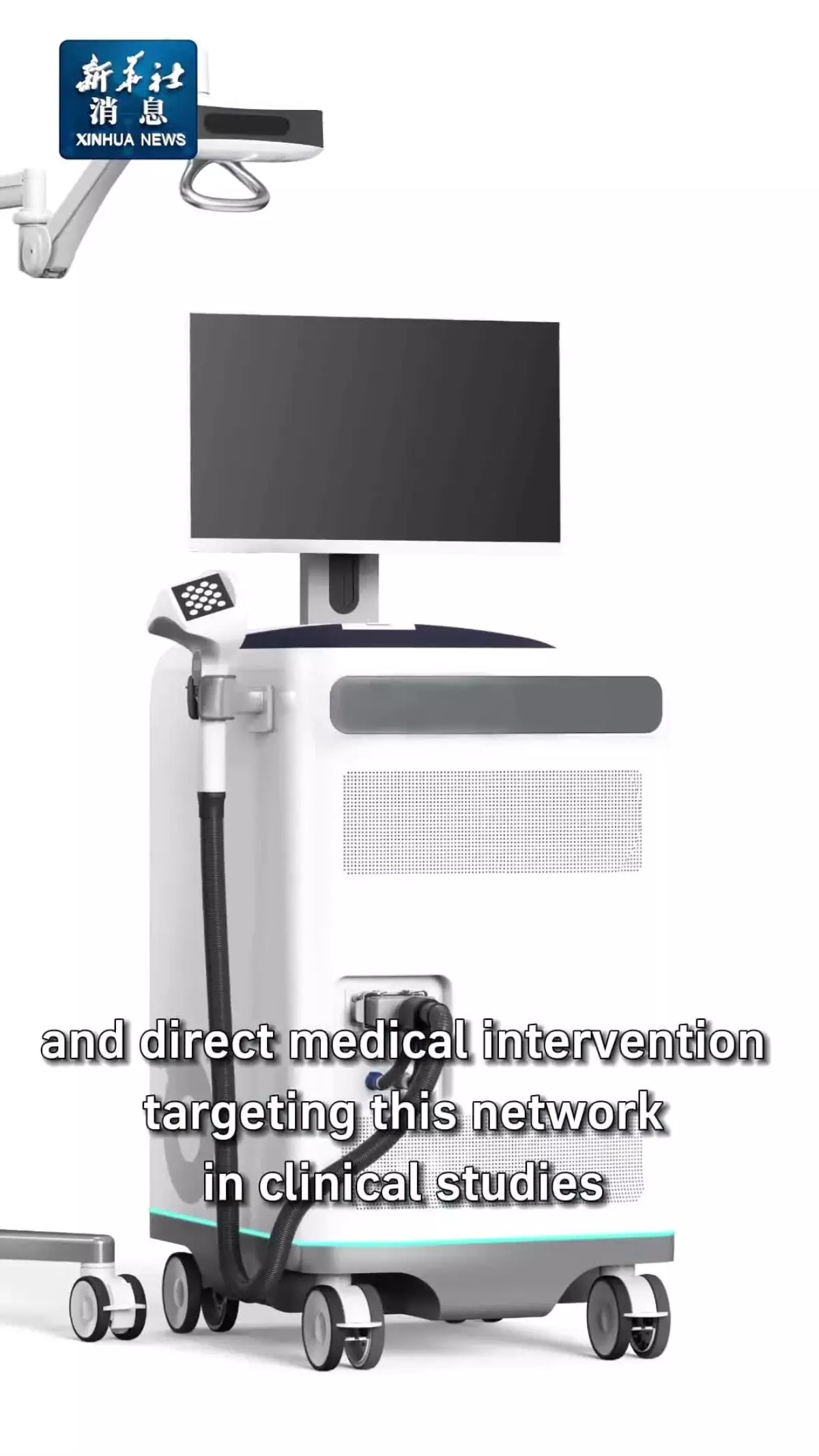 Çinli Bilim İnsanları Parkinson Ağı Keşfetti