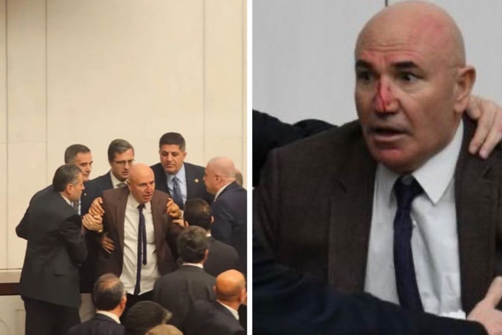 Meclis’teki kavgada Mahmut Tanal’ın burnu kanadı