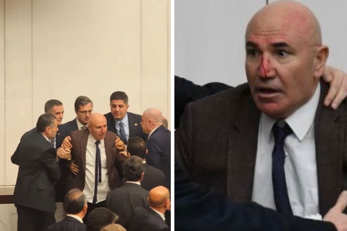 Meclis’teki kavgada Mahmut Tanal’ın burnu kanadı