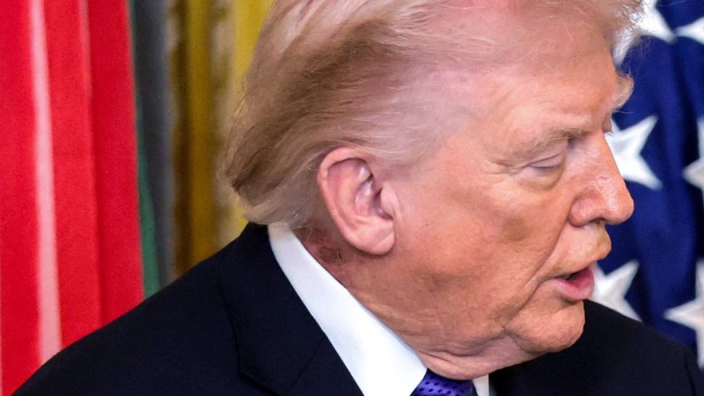 Trump’ın boynundaki leke gündem oldu: Beyaz Saray’dan açıklama geldi
