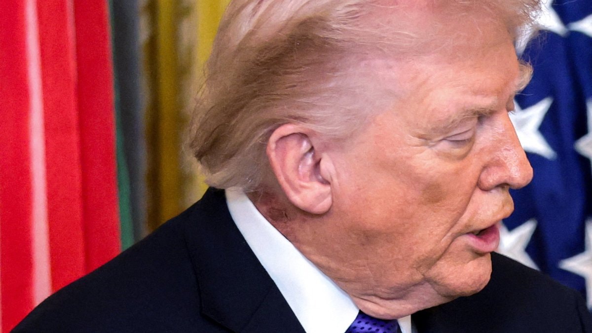 Trump’ın boynundaki leke gündem oldu: Beyaz Saray’dan açıklama geldi