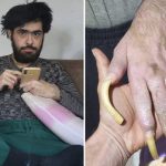 Türkiye’nin konuştuğu Barış’ın yeni işini ve son halini görenler şaşıp kalıyor